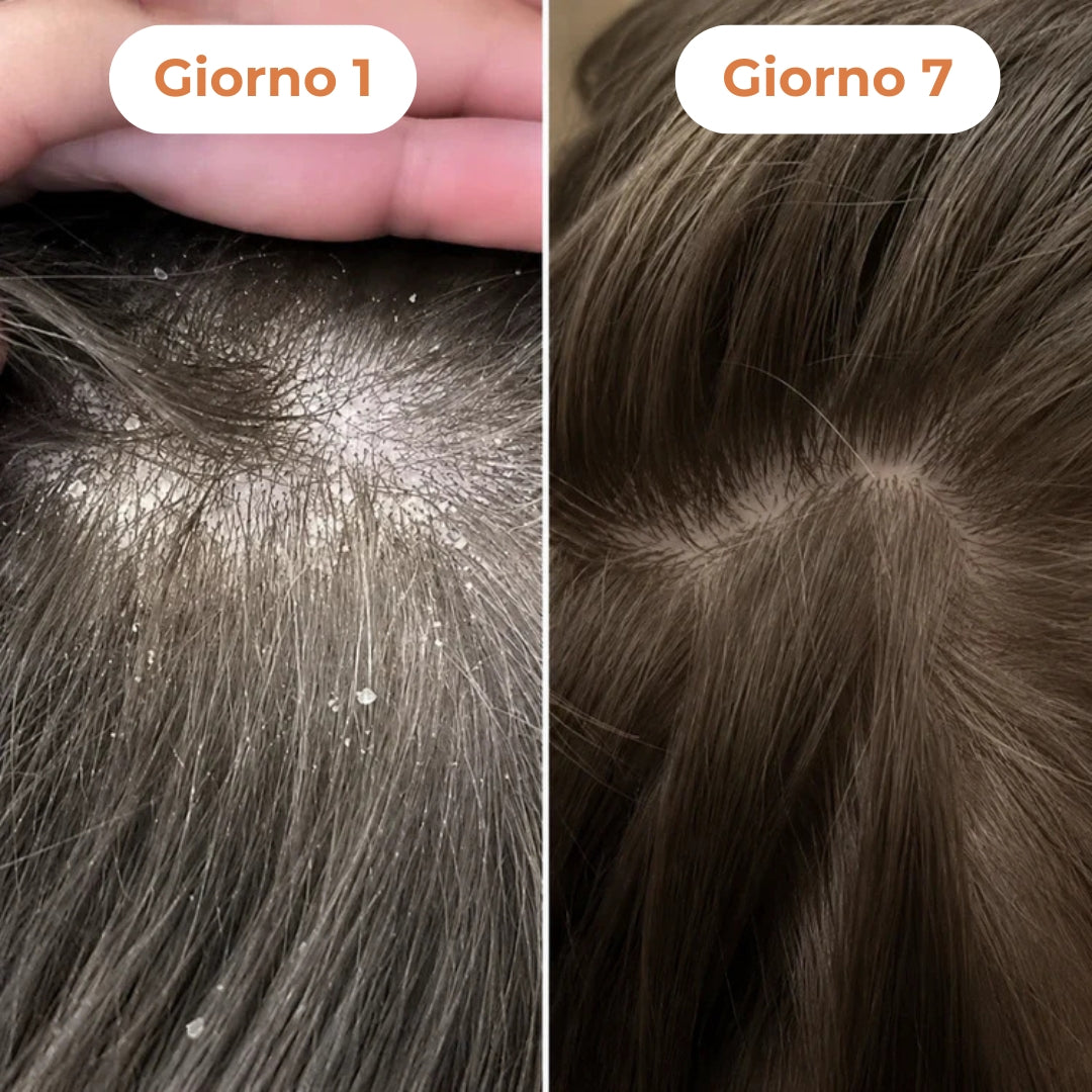 Siero Coreano Ricrescita Capelli Donna con Applicatore Massaggiante