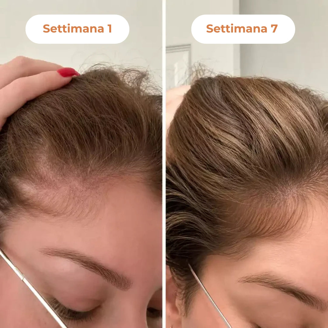 Siero Coreano Ricrescita Capelli Donna con Applicatore Massaggiante
