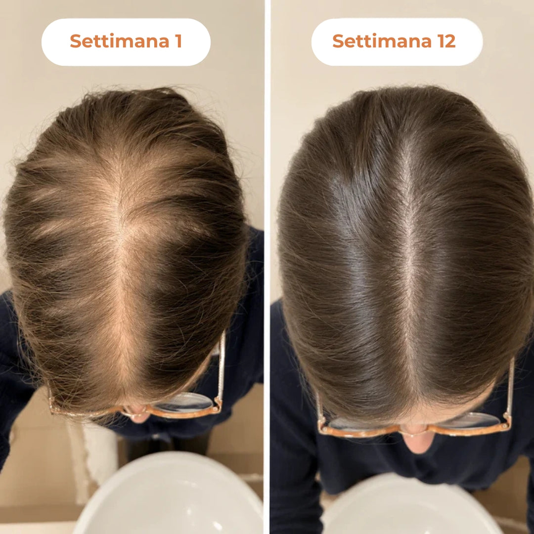 Siero Coreano Ricrescita Capelli Donna con Applicatore Massaggiante